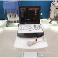 Diretamente inovadora trole doppler colorido 3D 4D ultra-sonografia e equipamentos médicos de alta qualidade